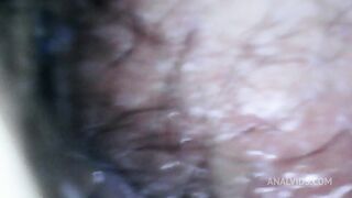 hairy ass exploration with endoscope and farts 4k
