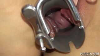 Violeta's orgasms with a speculum in her vagina