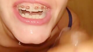 Gf With Braces Is Sucking His Junk